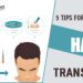 5 Tips for Successful Hair transplant