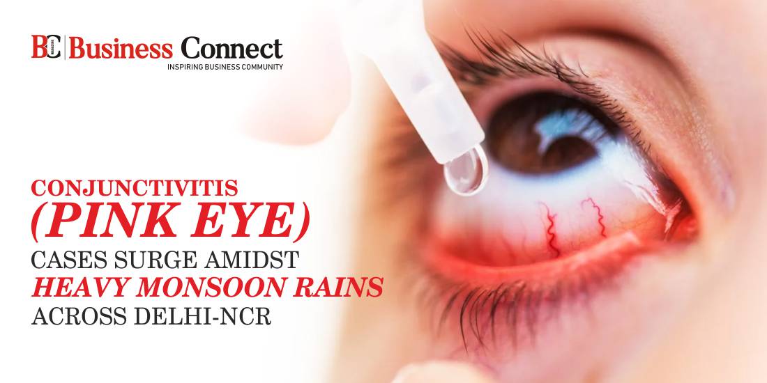 Conjunctivitis (Pink Eye) Cases Surge Amidst Heavy Monsoon Rains Across Delhi-NCR