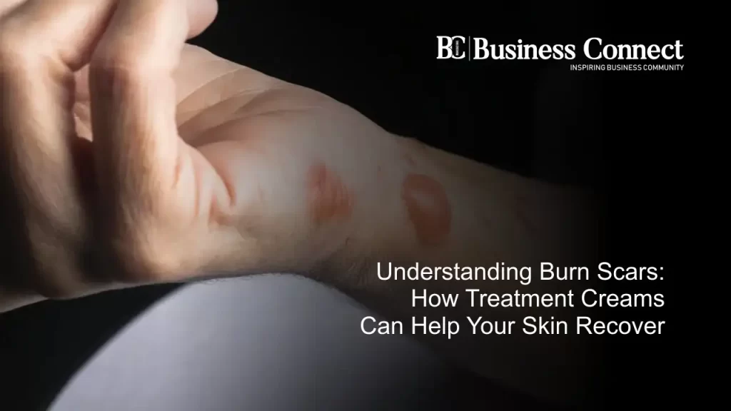Understanding Burn Scars: How Treatment Creams Can Help Your Skin Recover