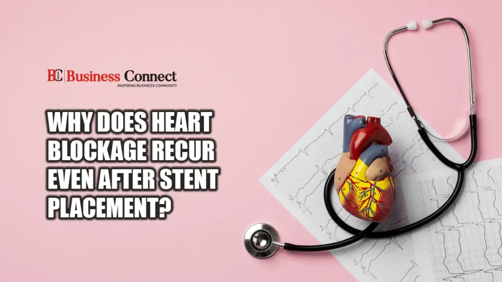 Why Does Heart Blockage Recur Even After Stent Placement? Why Does Heart Blockage Recur Even After Stent Placement?