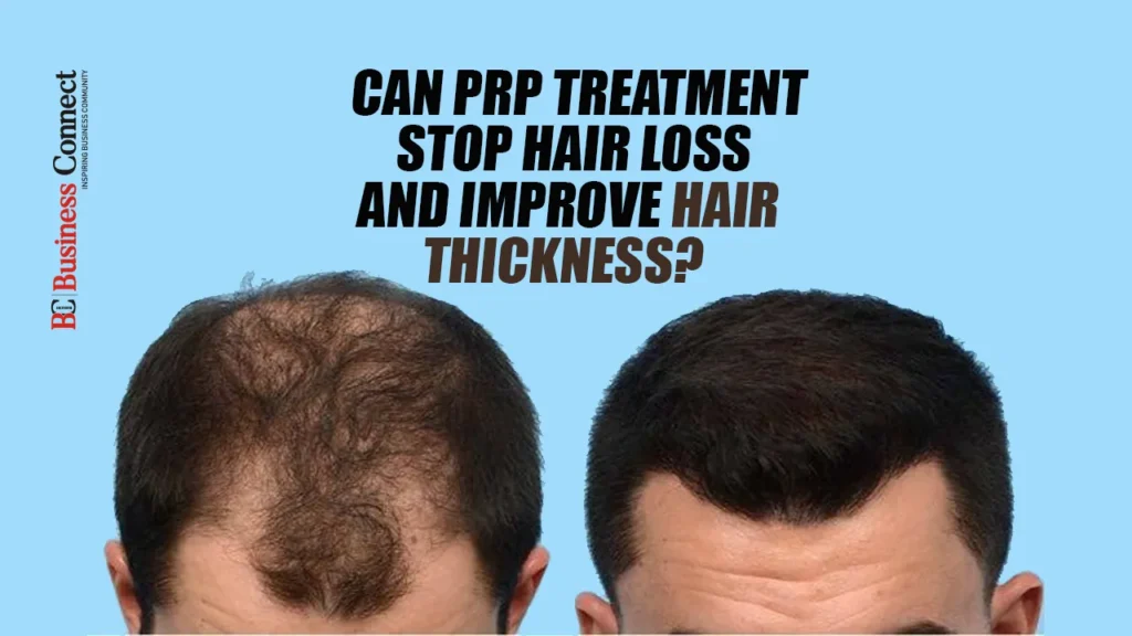Can PRP Treatment Stop Hair Loss and Improve Hair Thickness? Can PRP Treatment Stop Hair Loss and Improve Hair Thickness?